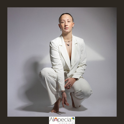alopecia-bold-visual