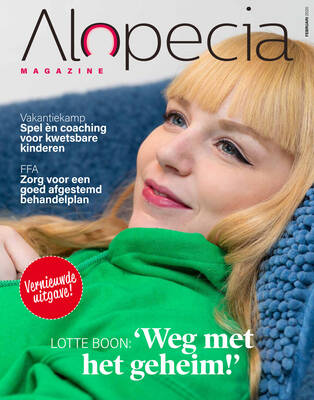 alopecia-magazine-februari-2020-cover