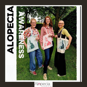 alopecia-visual-awareness